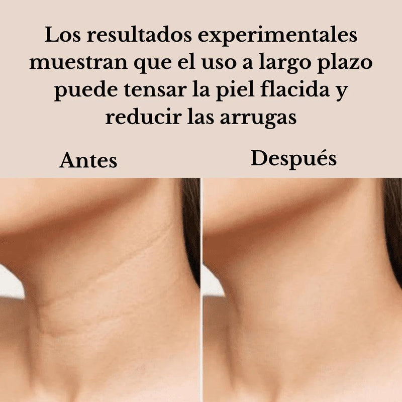 Masajeador Facial Reductor Arrugas Y Papada Recargable - Offertienda